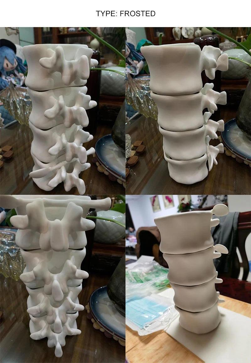 TingKe-Nordic Ins Style Creative Spine Shape Combination Ceramic Coffee Cup, Water Cup, Funny Orthopedic Doctor Gift, Bone Mug