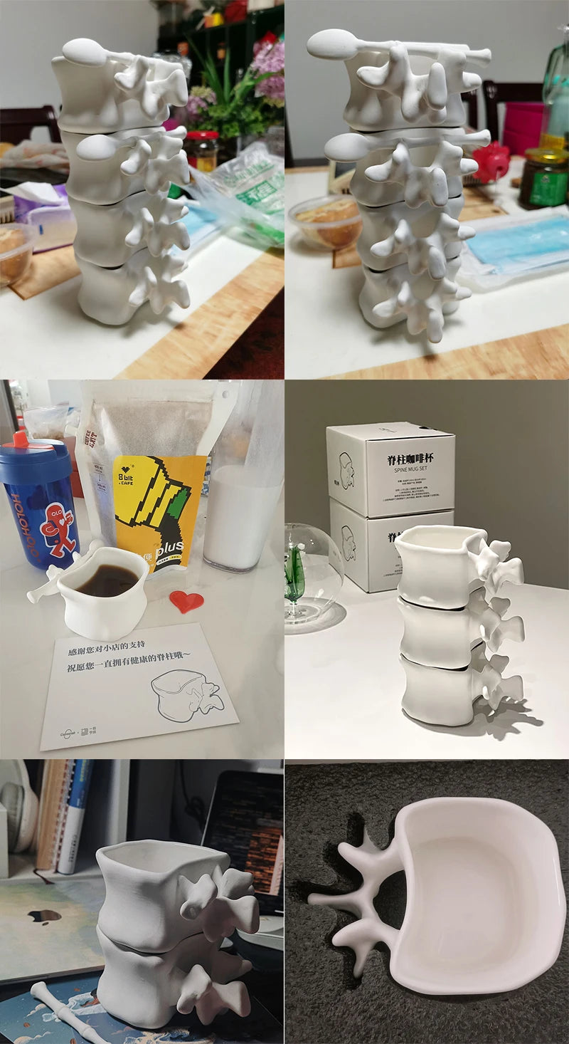 TingKe-Nordic Ins Style Creative Spine Shape Combination Ceramic Coffee Cup, Water Cup, Funny Orthopedic Doctor Gift, Bone Mug